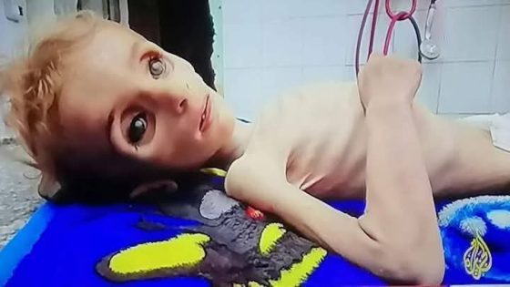غزة ٱلعزة:صمود لآخر نفس